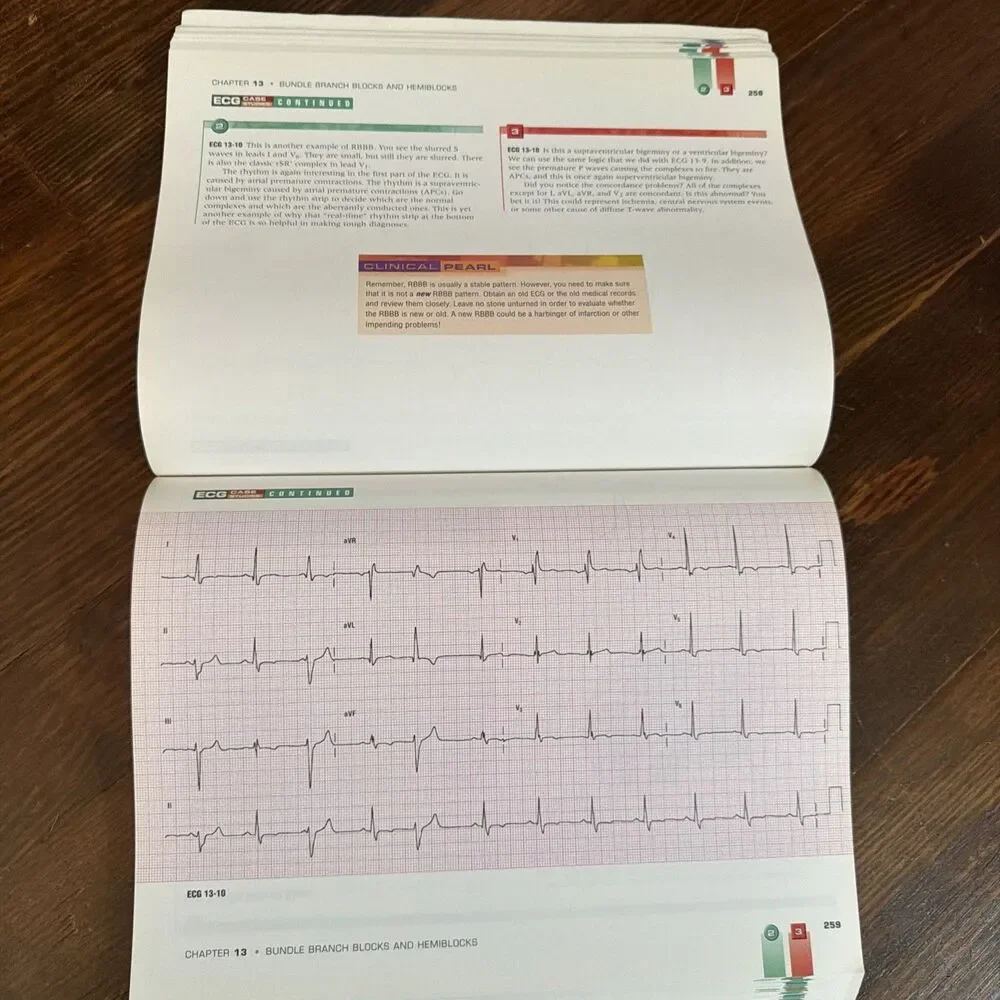 12-Lead ECG: The Art of Interpretation by Garcia & Holtz